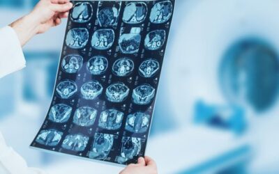 La complessità nel mondo del diagnostico: quando l’offerta è un progetto su misura